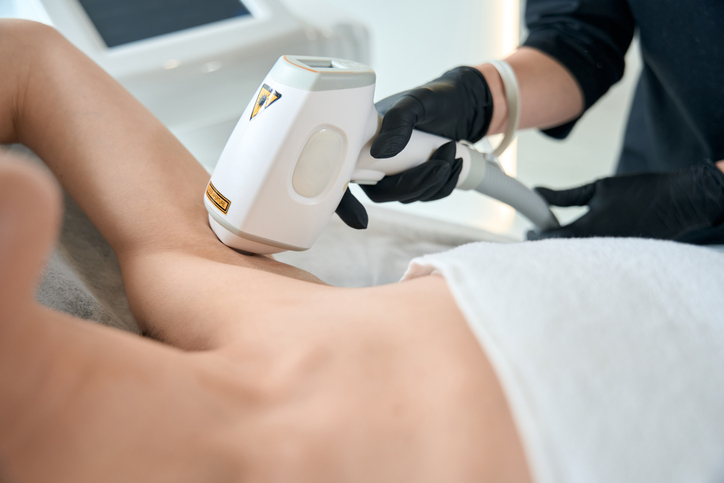 Diferencias entre la depilación por laser y fotodepilación